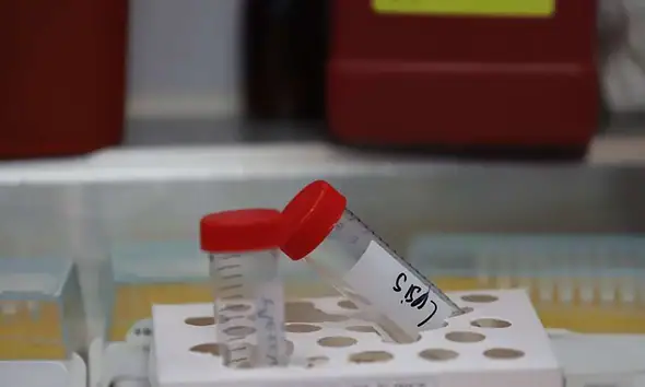 Muestras de ADN en Zapopan