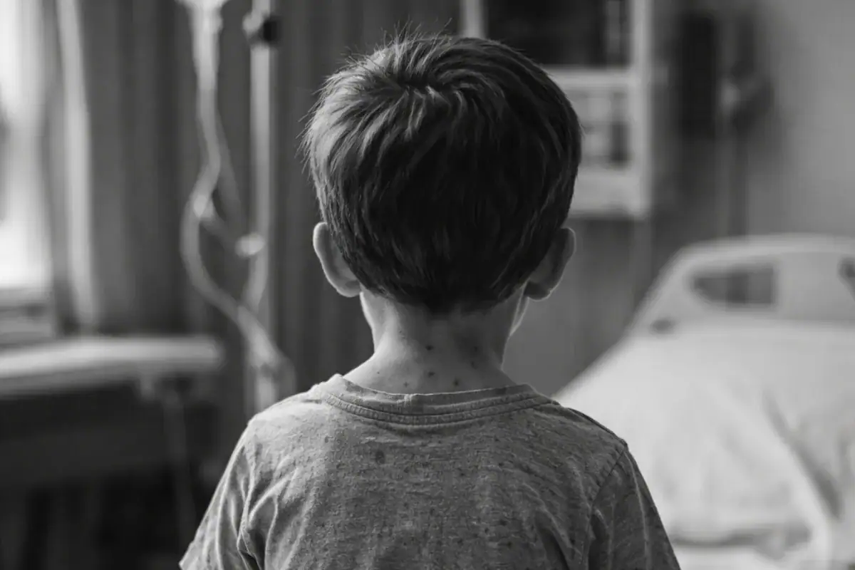 Jalisco registra primera muerte por sarampión en 2026; suman tres decesos