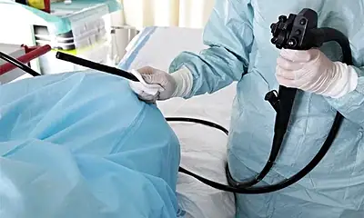 Alertan por casos de cáncer colorrectal en jóvenes