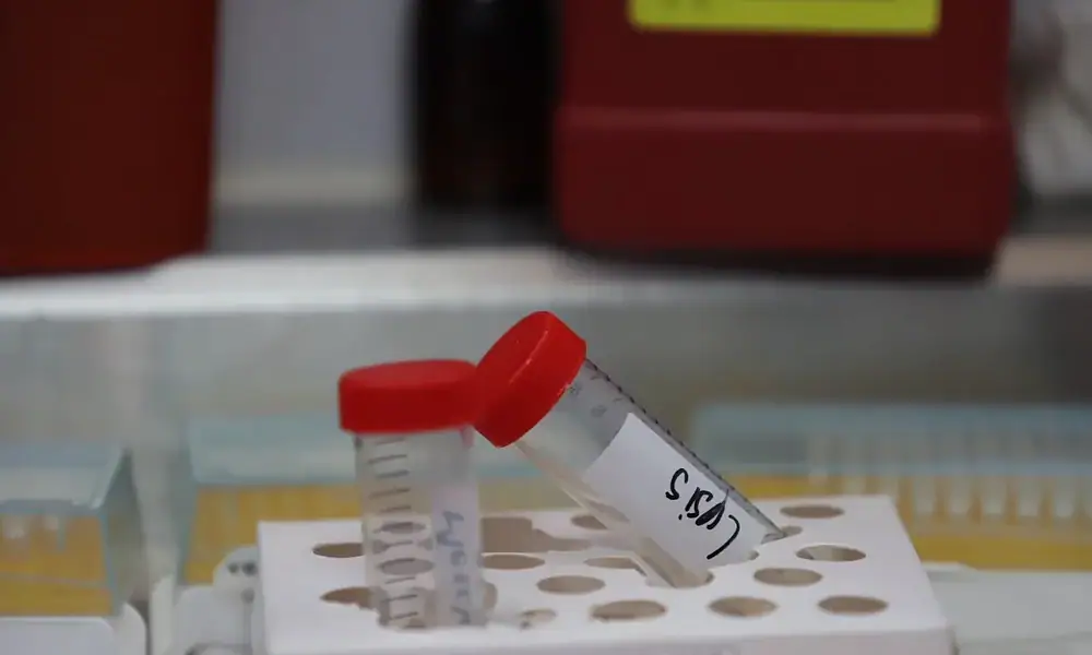 Personal forense prepara material para tomar una muestra de ADN durante una jornada de atención a familias de personas desaparecidas.