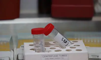 Personal forense prepara material para tomar una muestra de ADN durante una jornada de atención a familias de personas desaparecidas.