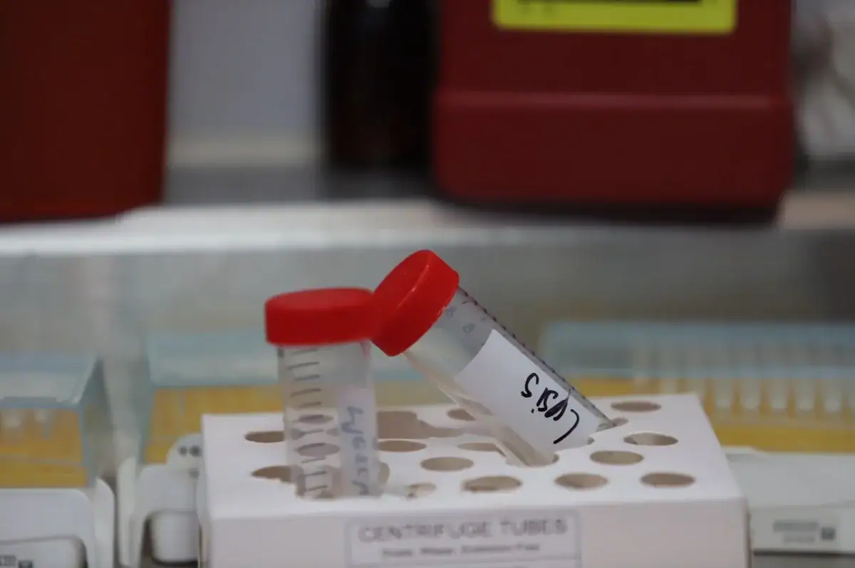 Personal forense prepara material para tomar una muestra de ADN durante una jornada de atención a familias de personas desaparecidas.